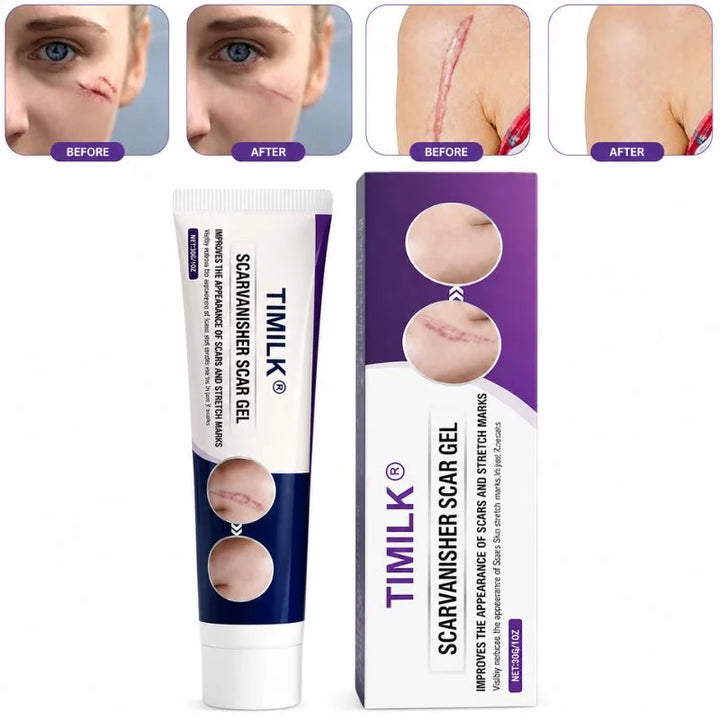 TIMILK Scar Removal Gel for Face & Body - Stretch Marks & Old Scars Repair Cream, Smooth Skin Treatment, 30g