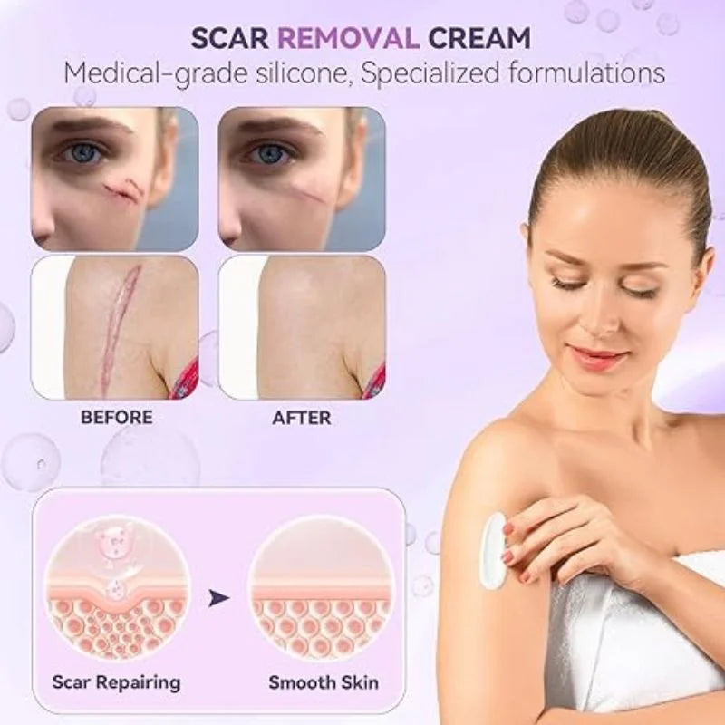 TIMILK Scar Removal Gel for Face & Body - Stretch Marks & Old Scars Repair Cream, Smooth Skin Treatment, 30g