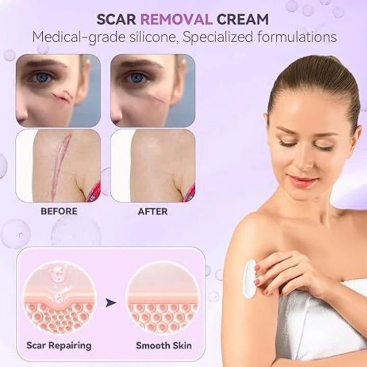 TIMILK Scar Removal Gel for Face & Body - Stretch Marks & Old Scars Repair Cream, Smooth Skin Treatment, 30g